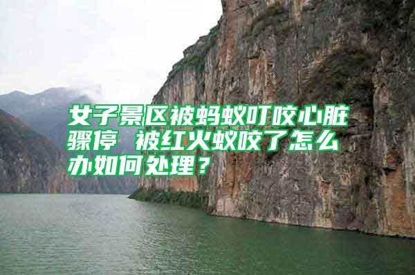 女子景區(qū)被螞蟻叮咬心臟驟停 被紅火蟻咬了怎么辦如何處理？
